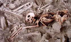 4500 yıllık kafatası ameliyatı