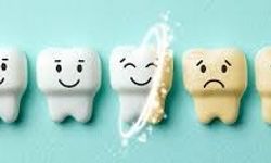 Diş sararması neden olur ve nasıl geçer?