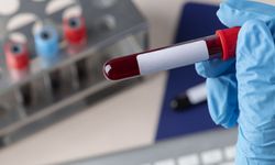Alzheimer teşhisinde devrim! İlk kan testine onay verildi
