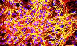 Alzheimer uyku hapıyla yavaşlatılacak!