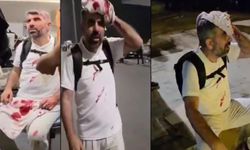 Milletvekili   başından    yaralandı
