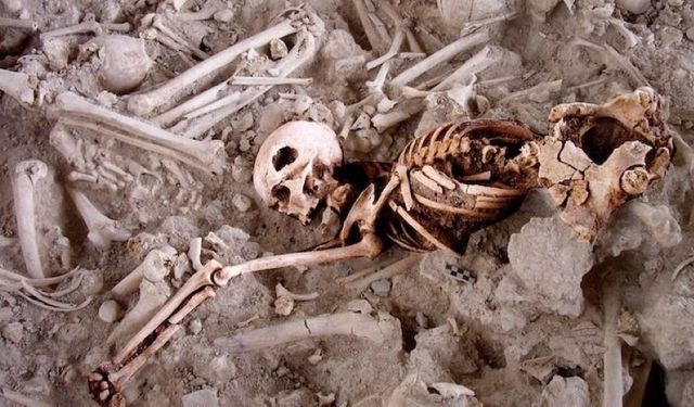 4500 yıllık kafatası ameliyatı