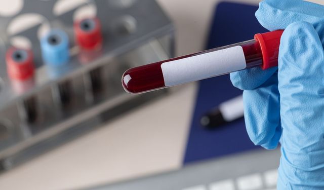 Alzheimer teşhisinde devrim! İlk kan testine onay verildi