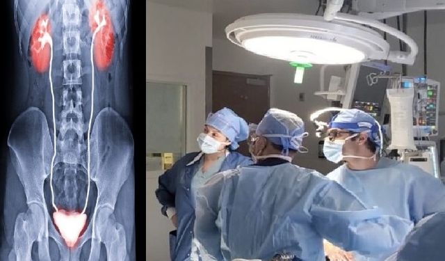 Dünyada bir ilk! Mesane nakliyle hayata döndü