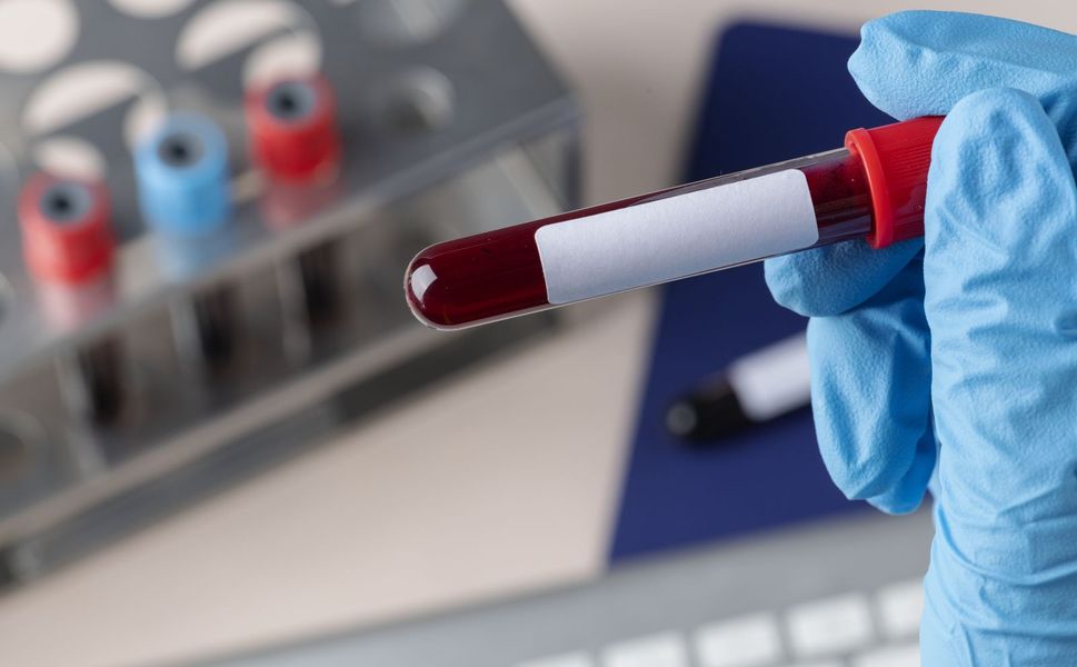 Alzheimer teşhisinde devrim! İlk kan testine onay verildi